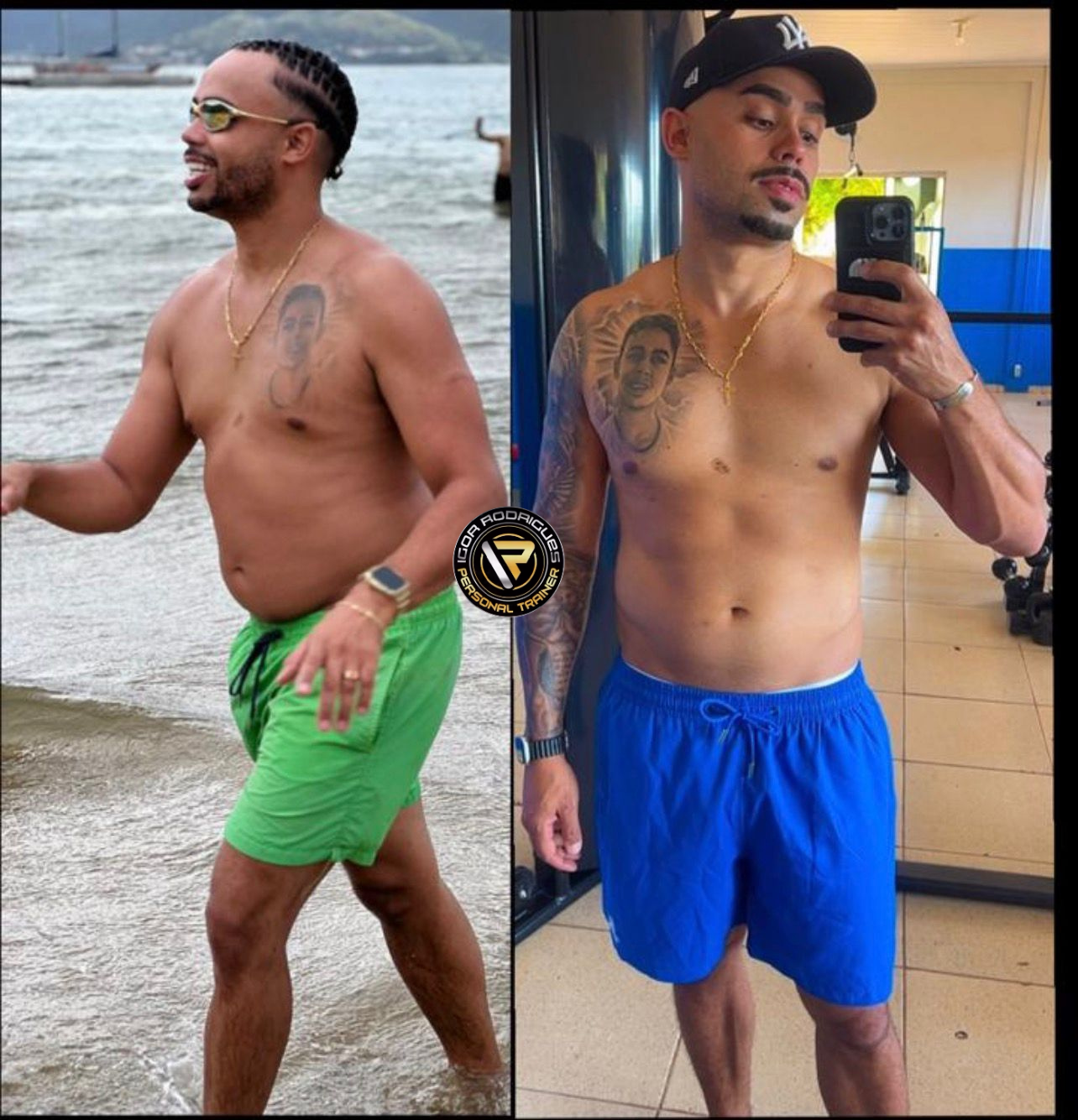 Antes e Depois - Resultado de Hipertrofia